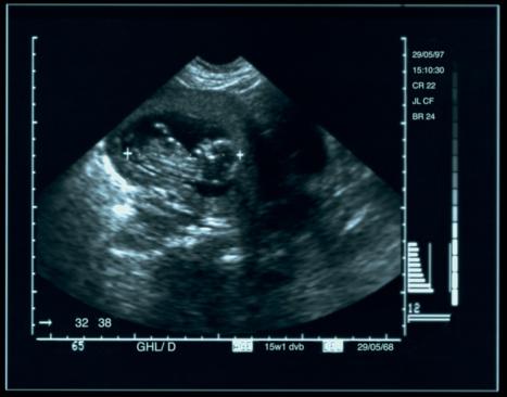 Nauènici tvrde da su posmatrali fetus dok masturbira
